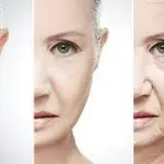 Come combattere i segni dell’invecchiamento cutaneo
